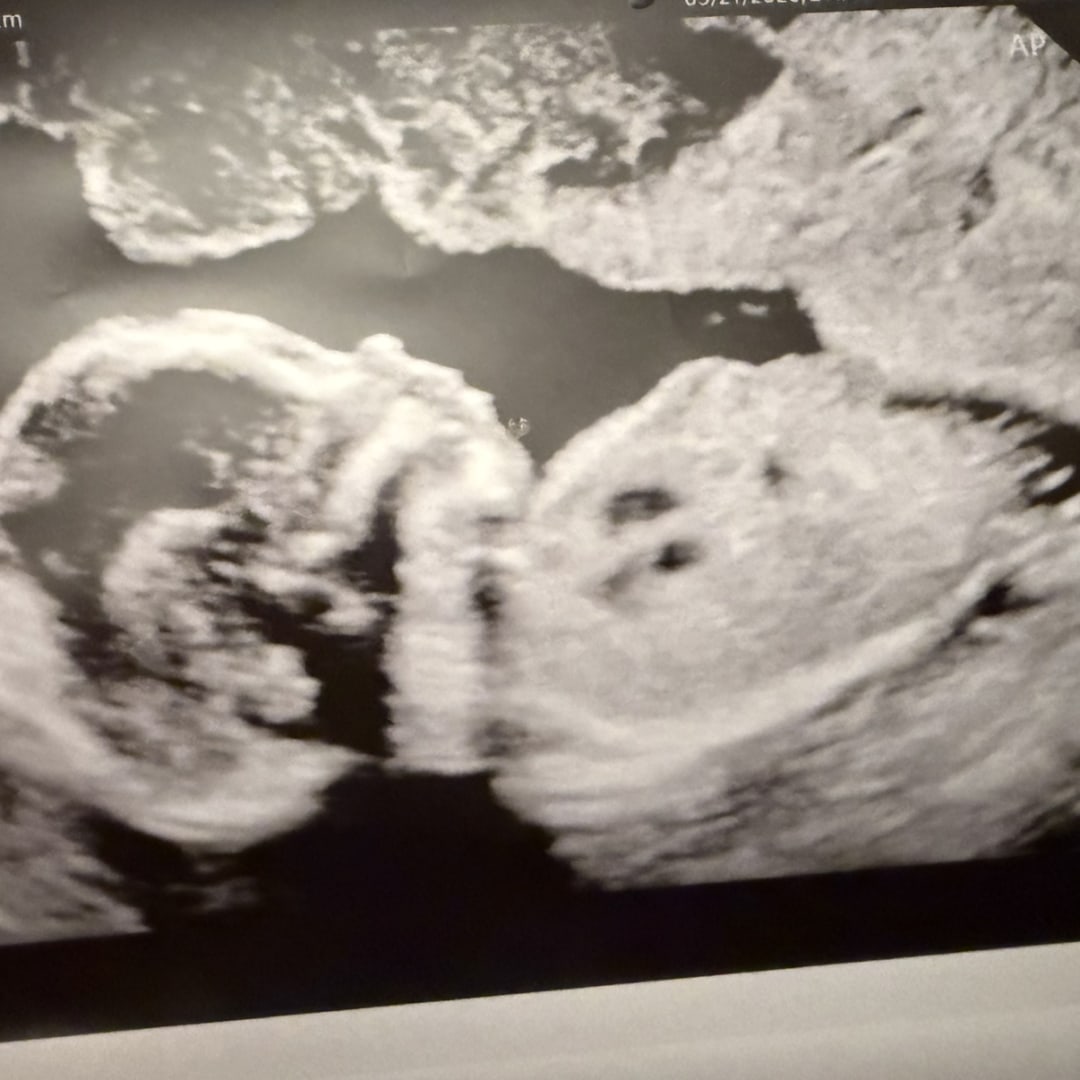 Photo shared by Jayai for their Babylist baby registry.