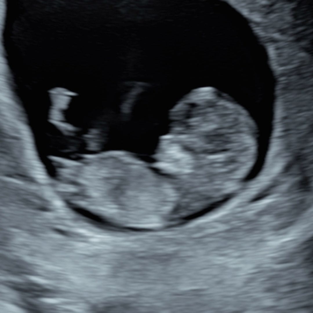 Photo shared by Uta for their Babylist baby registry.