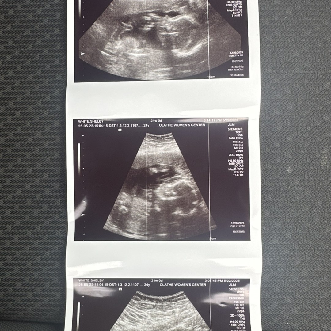Photo shared by Shelby for their Babylist baby registry.