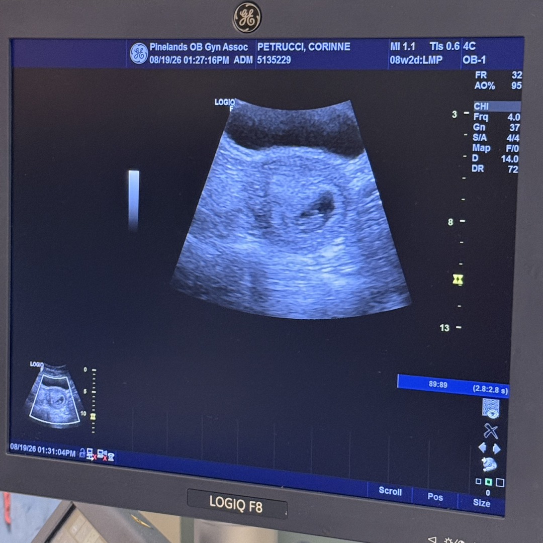 Photo shared by Corinne for their Babylist baby registry.