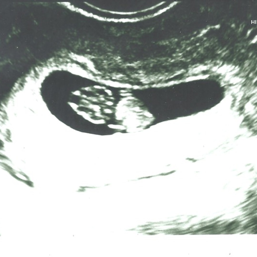 Photo shared by Jessica for their Babylist baby registry.