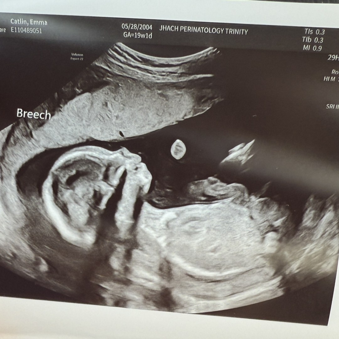 Photo shared by Emma for their Babylist baby registry.