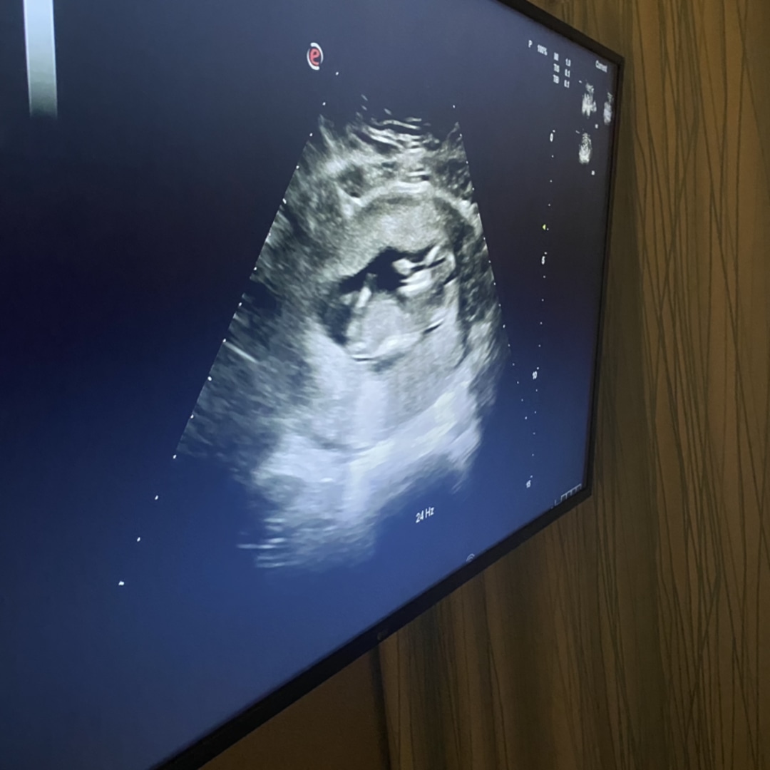 Photo shared by Jocelynn for their Babylist baby registry.