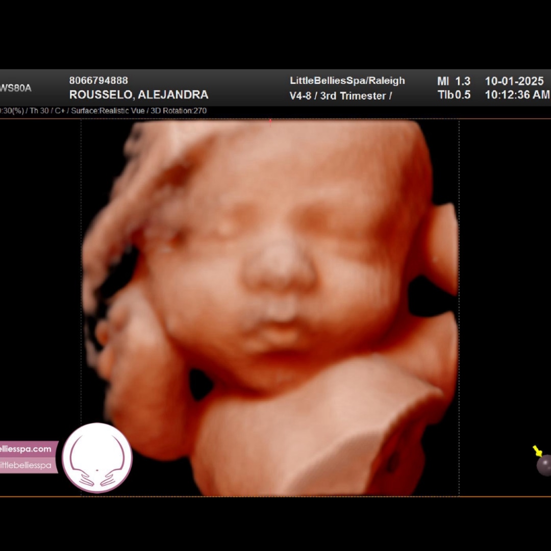 Photo shared by Ali for their Babylist baby registry.