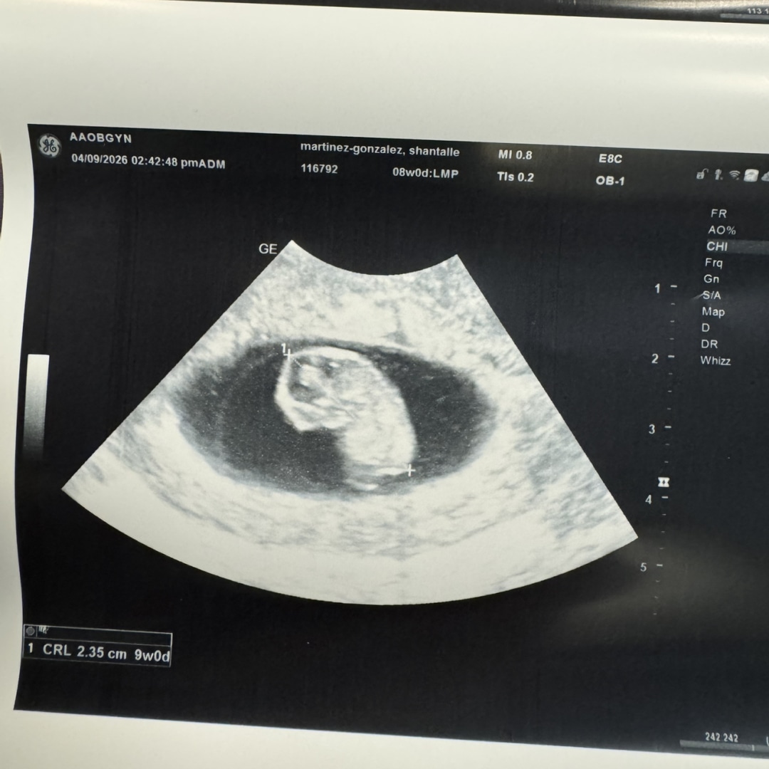 Photo shared by Shantalle for their Babylist baby registry.