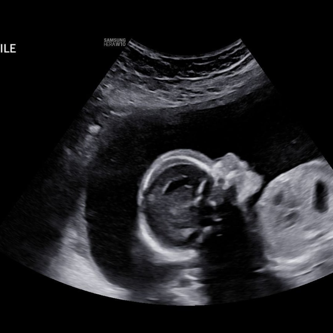 Photo shared by Lauren for their Babylist baby registry.