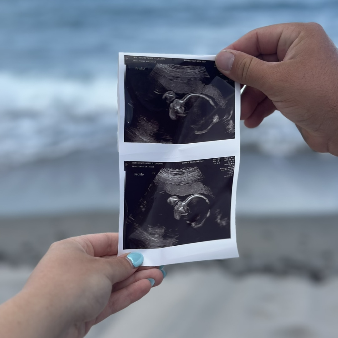 Photo shared by Darby for their Babylist baby registry.