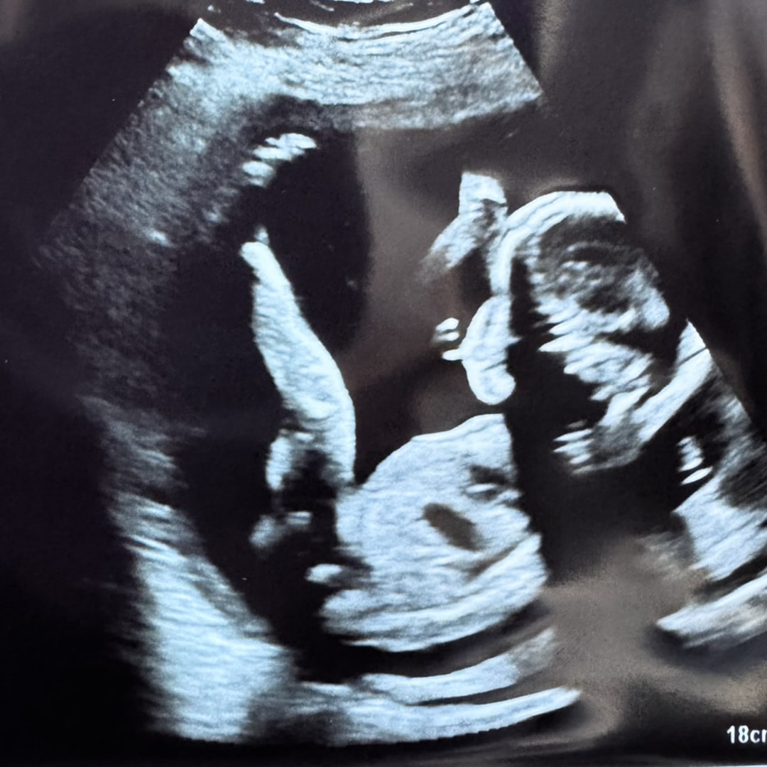 Photo shared by Maria for their Babylist baby registry.