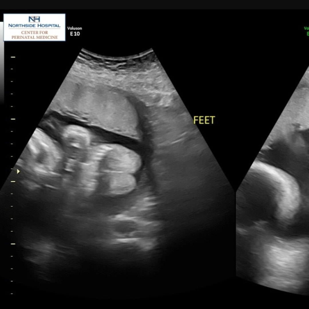 Photo shared by Lindsay for their Babylist baby registry.