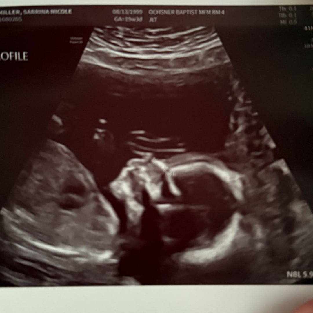 Photo shared by Sabrina for their Babylist baby registry.
