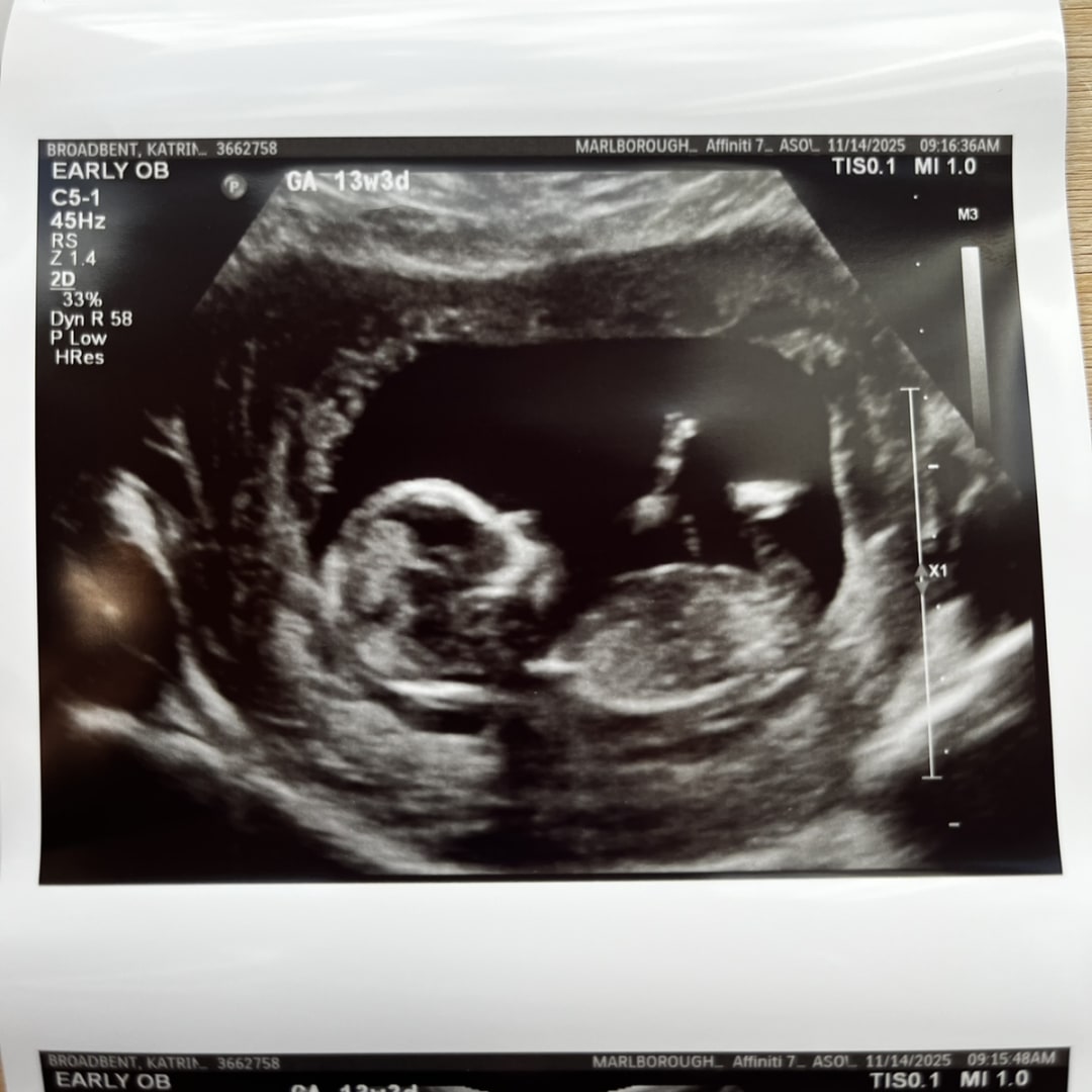 Photo shared by Katrina for their Babylist baby registry.