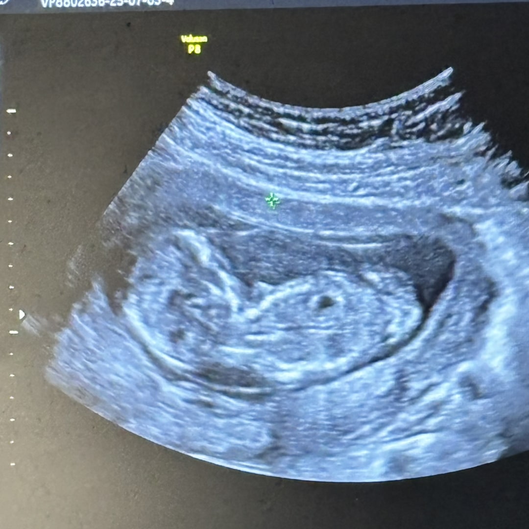Photo shared by Autumn for their Babylist baby registry.