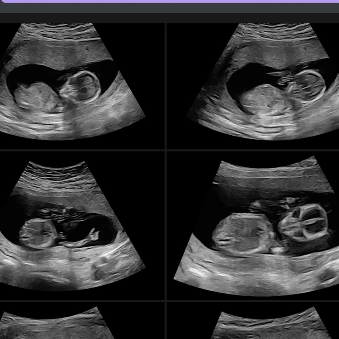 Photo shared by Kristen for their Babylist baby registry.