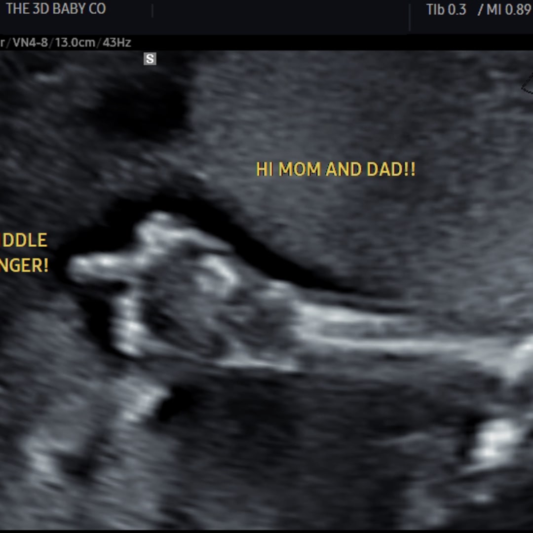 Photo shared by Michele for their Babylist baby registry.