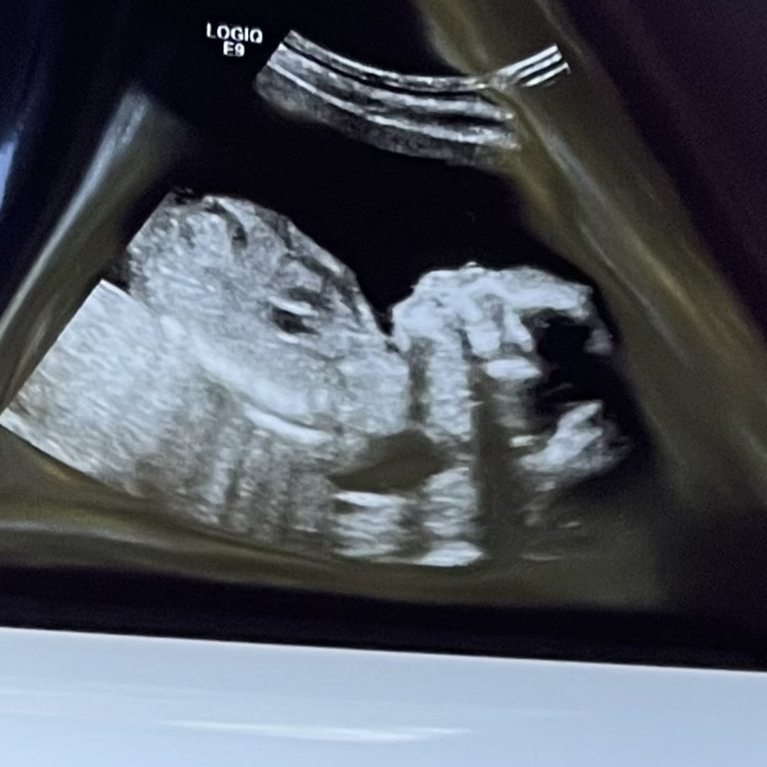 Photo shared by Zechariah & Madelyn for their Babylist baby registry.