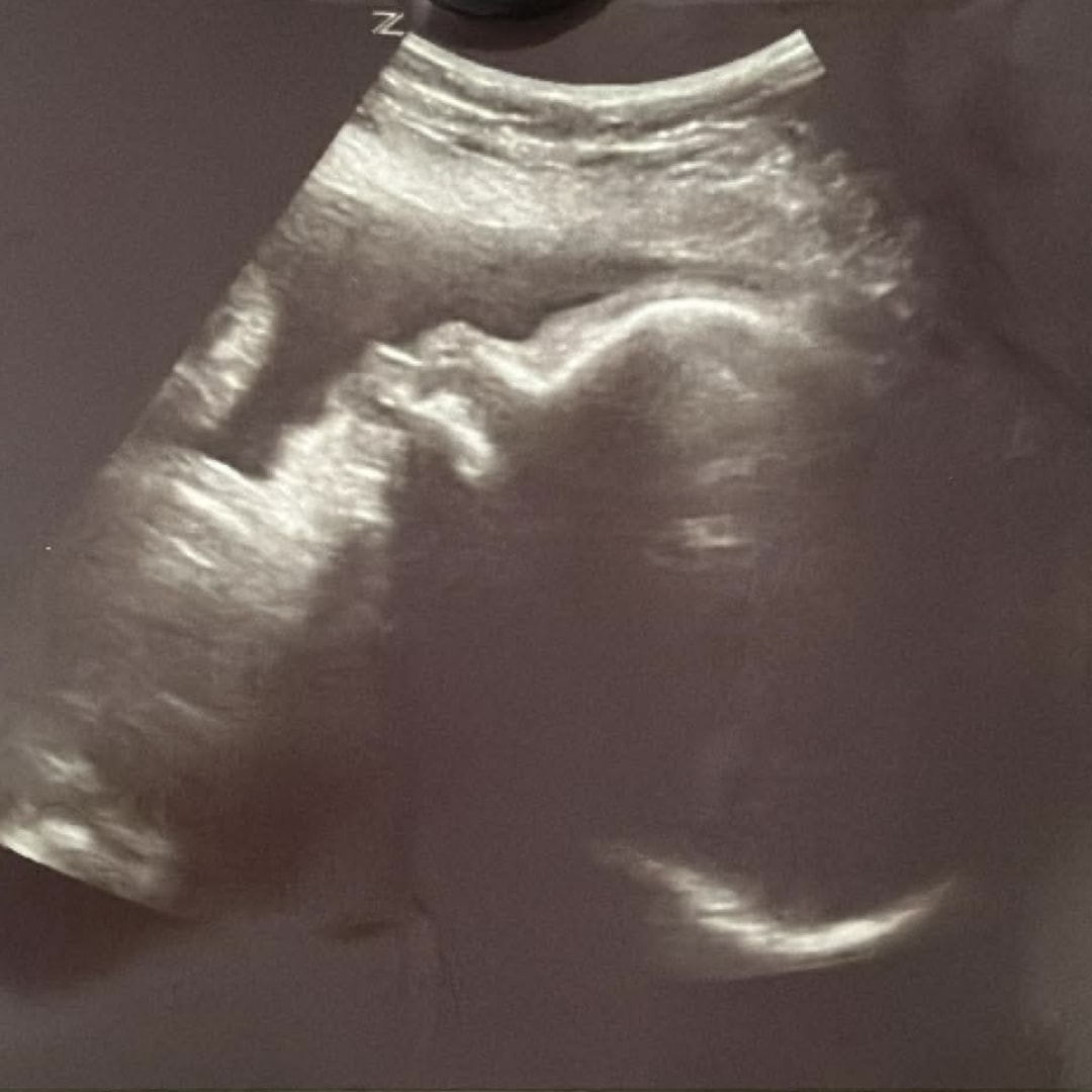 Photo shared by Maria for their Babylist baby registry.