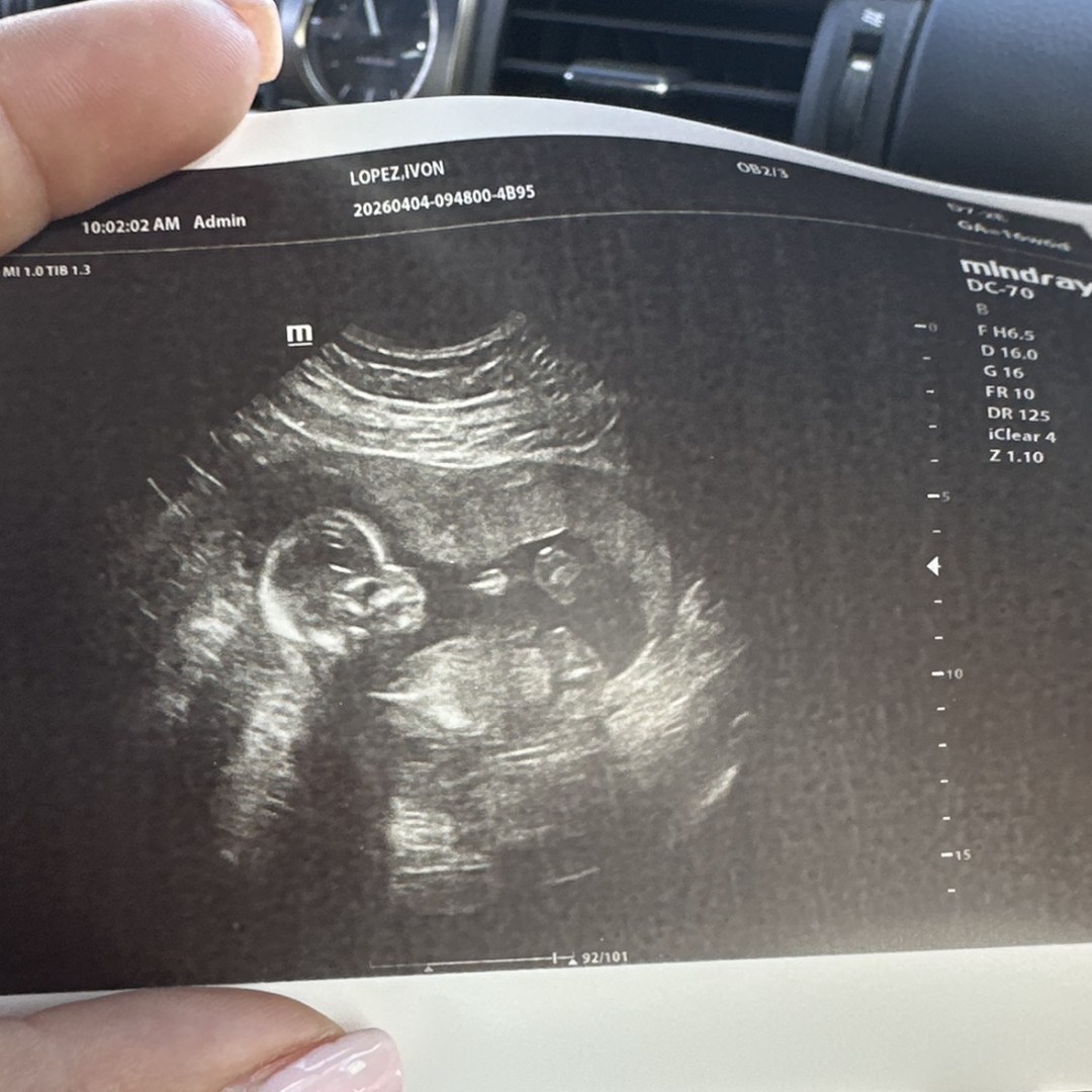 Photo shared by Ivon for their Babylist baby registry.