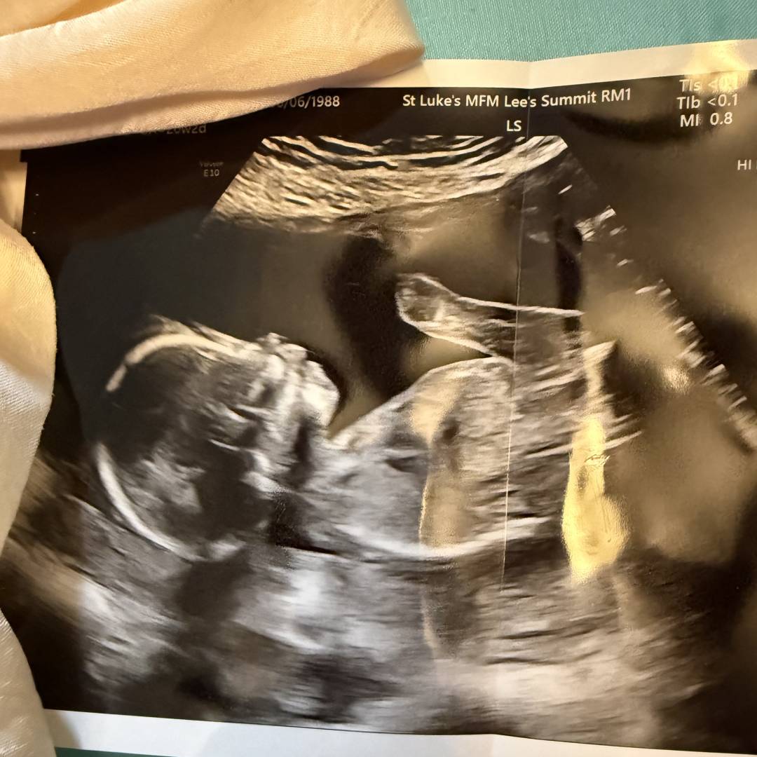 Photo shared by Terrie Sue for their Babylist baby registry.