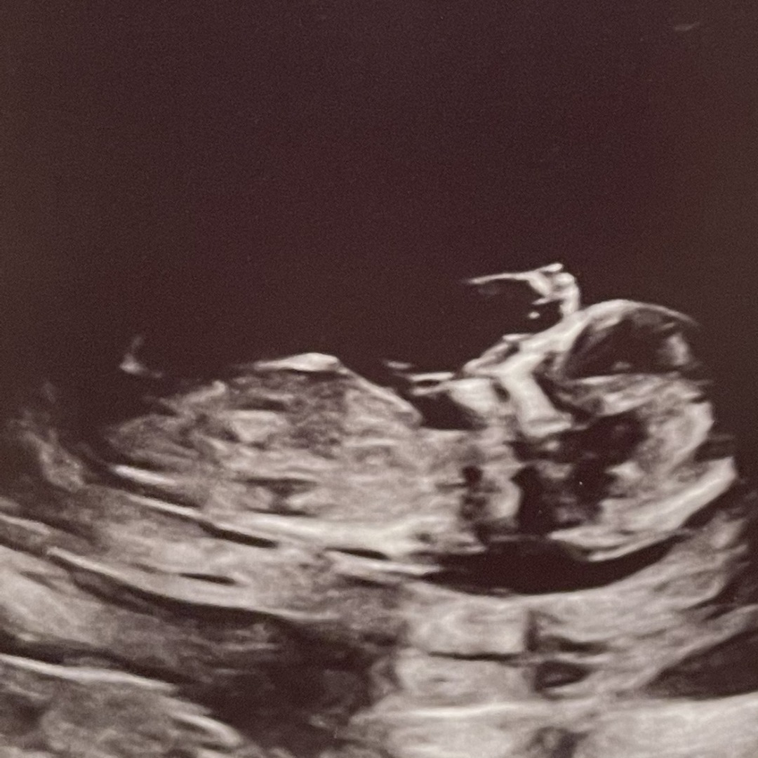 Photo shared by Olivia for their Babylist baby registry.