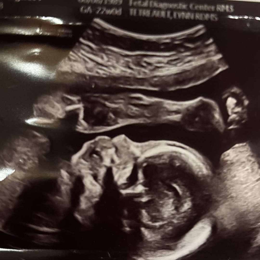 Photo shared by Maggie and John for their Babylist baby registry.