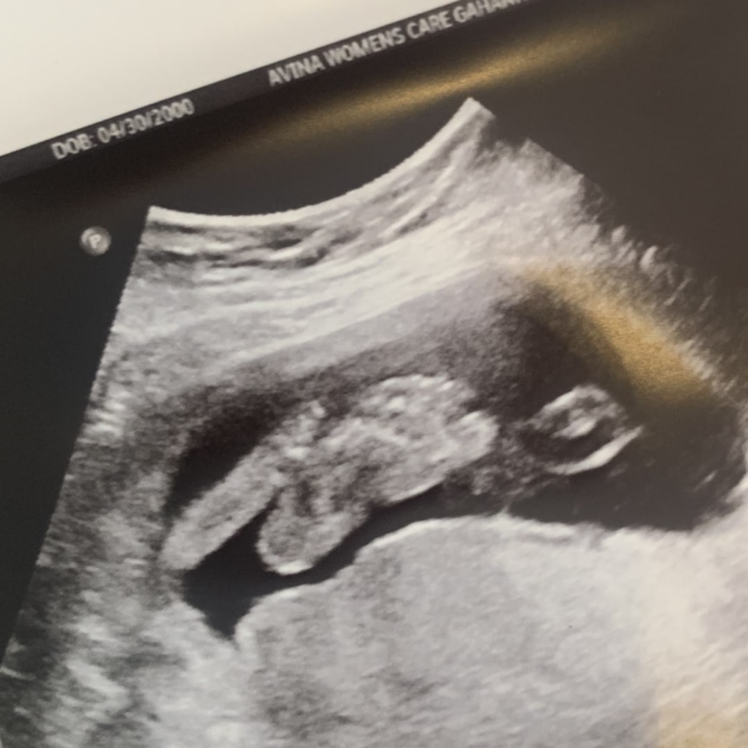 Photo shared by Anna for their Babylist baby registry.