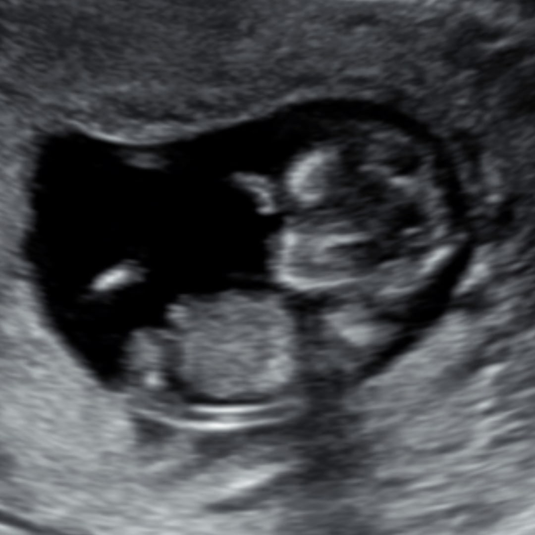 Photo shared by Audrey for their Babylist baby registry.