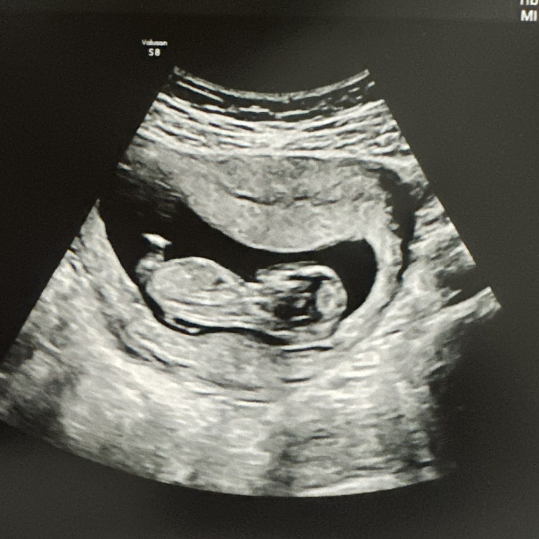 Photo shared by Hailey for their Babylist baby registry.