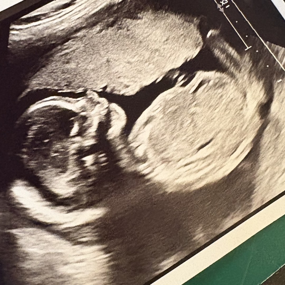 Photo shared by Baylie for their Babylist baby registry.