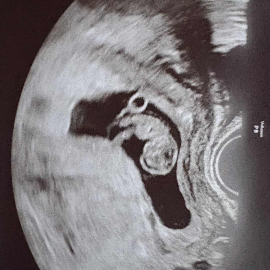 Photo shared by Nicole for their Babylist baby registry.