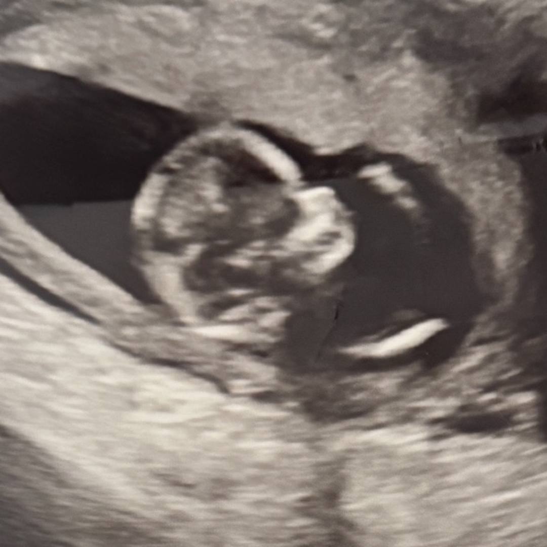 Photo shared by Alexa for their Babylist baby registry.