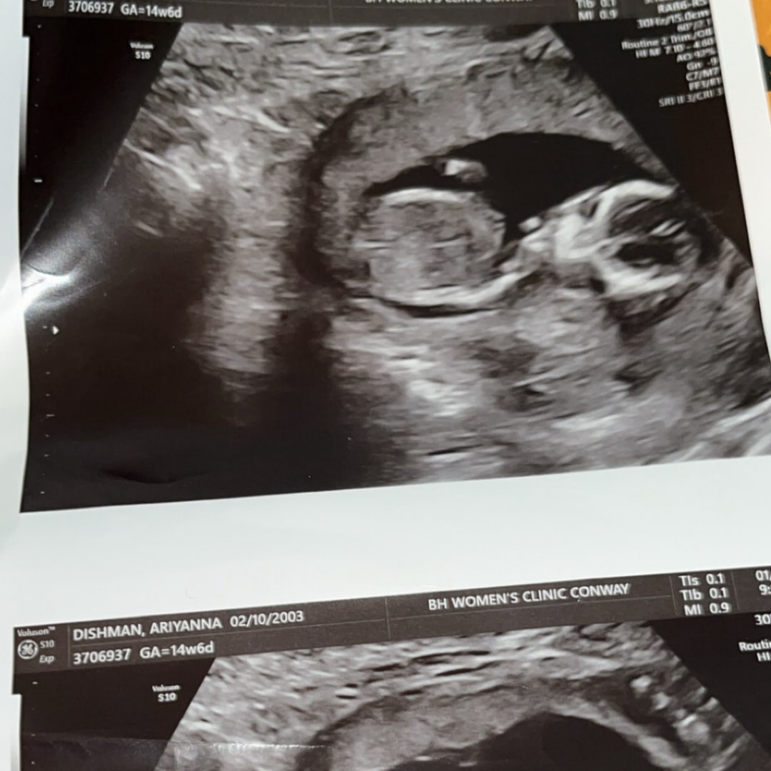 Photo shared by Ariyanna for their Babylist baby registry.