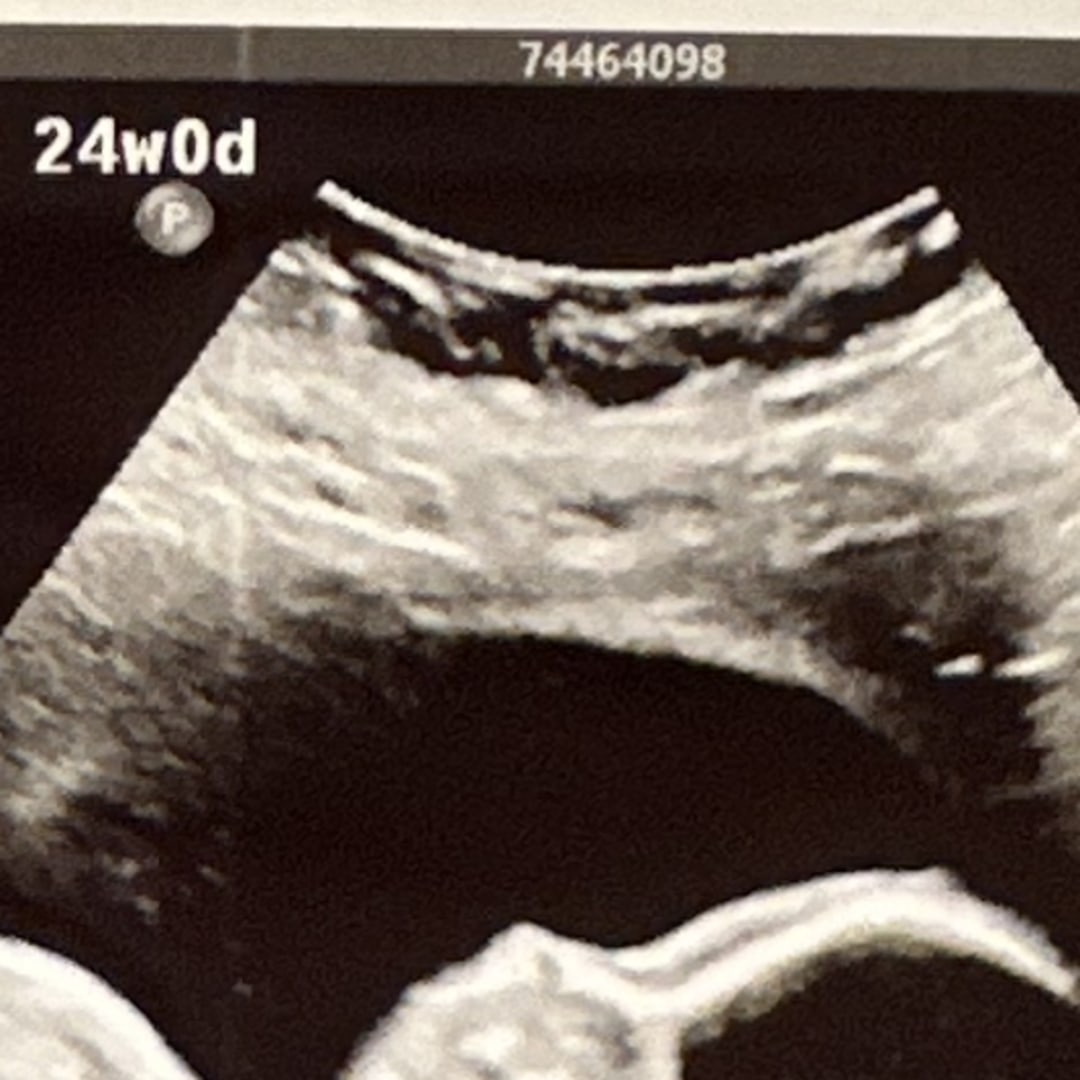 Photo shared by Lexie for their Babylist baby registry.