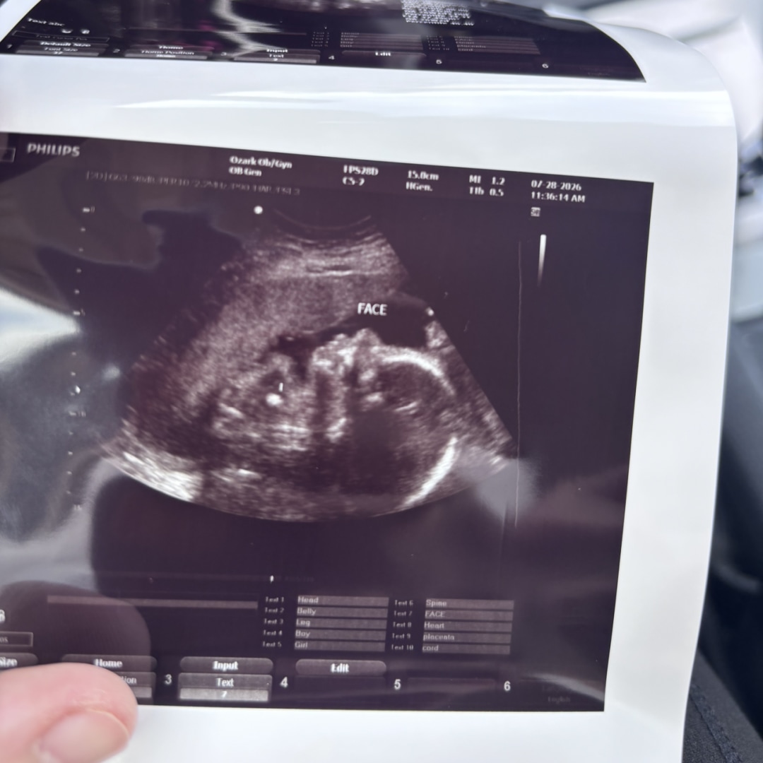 Photo shared by Breana for their Babylist baby registry.