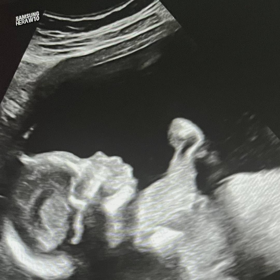 Photo shared by Gwen for their Babylist baby registry.