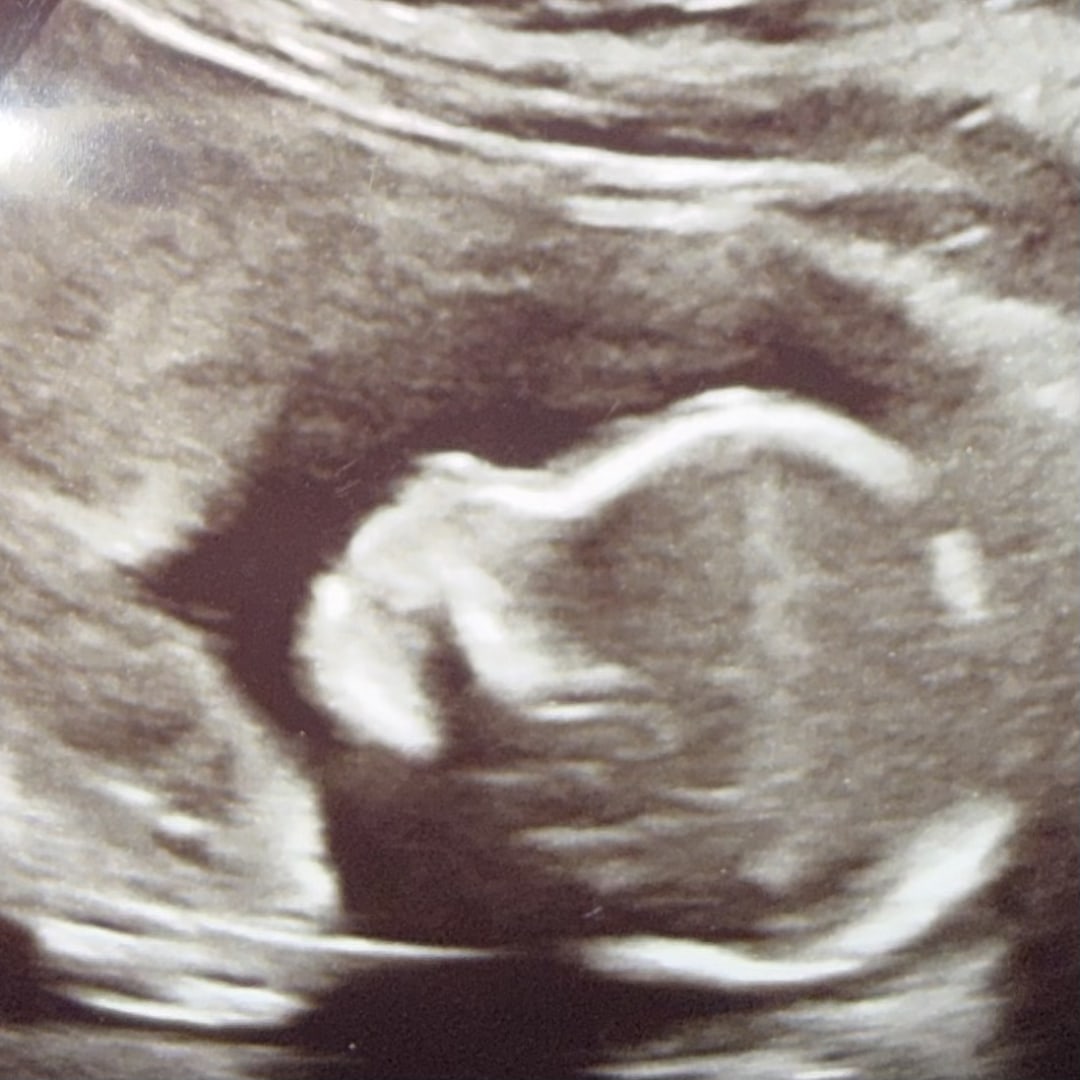 Photo shared by Shelby for their Babylist baby registry.