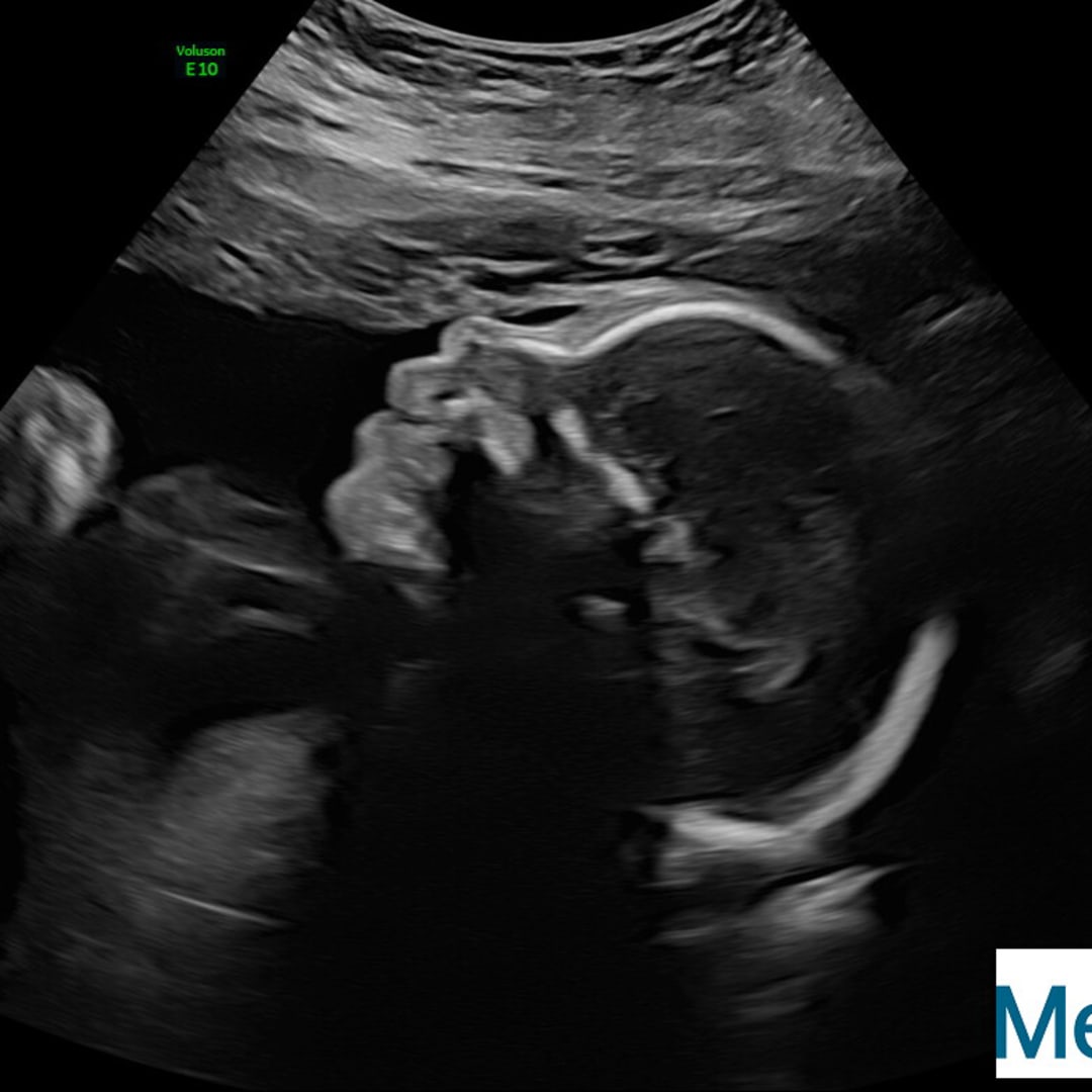 Photo shared by Bryanna for their Babylist baby registry.