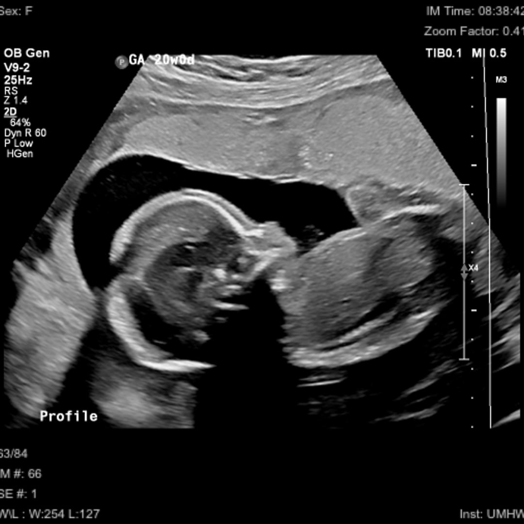 Photo shared by Cassidy for their Babylist baby registry.