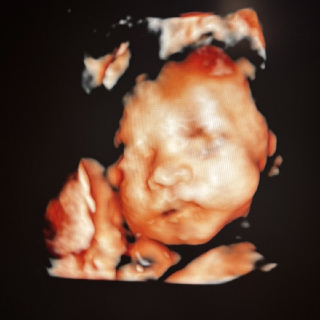 Photo shared by Ana for their Babylist baby registry.