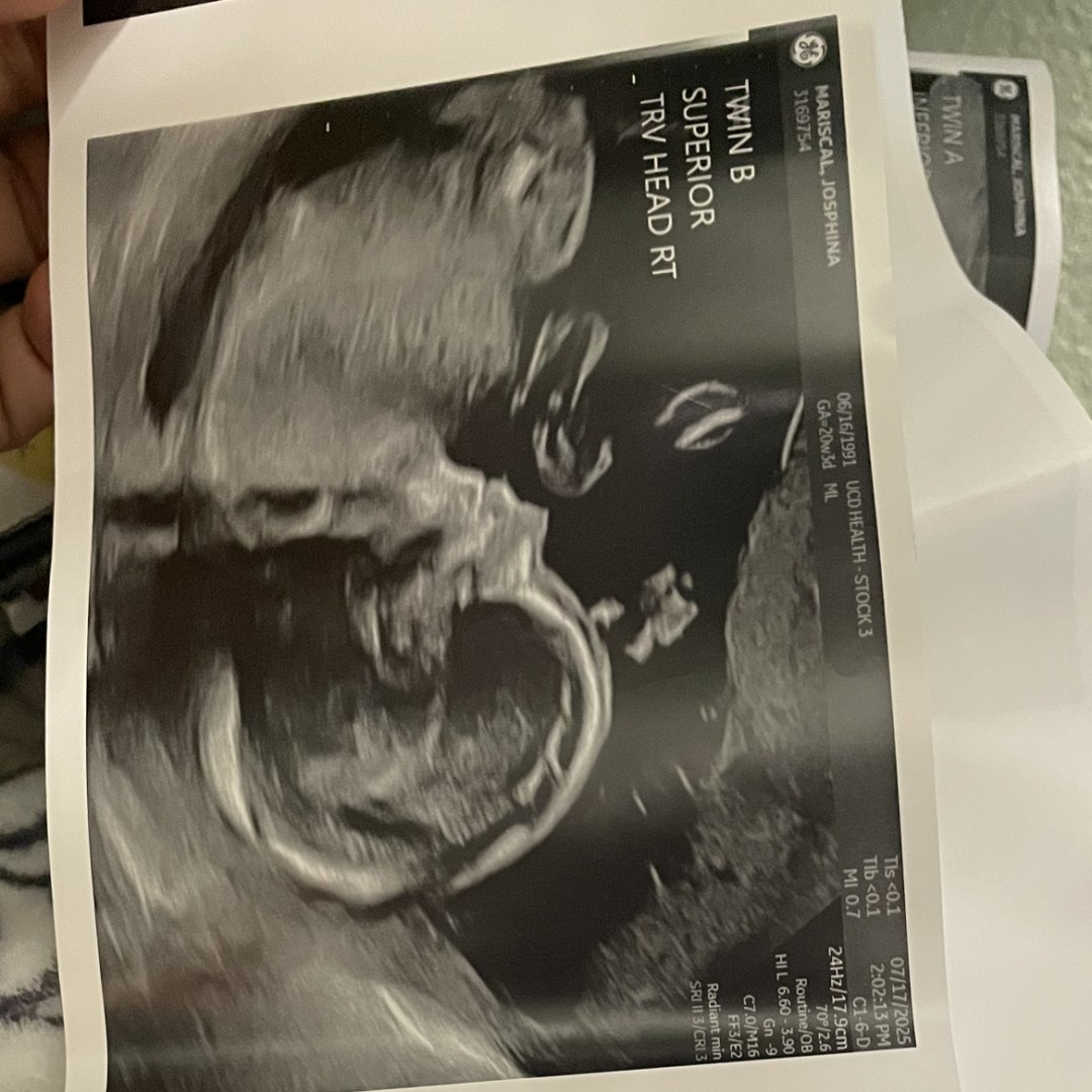 Photo shared by Josie for their Babylist baby registry.