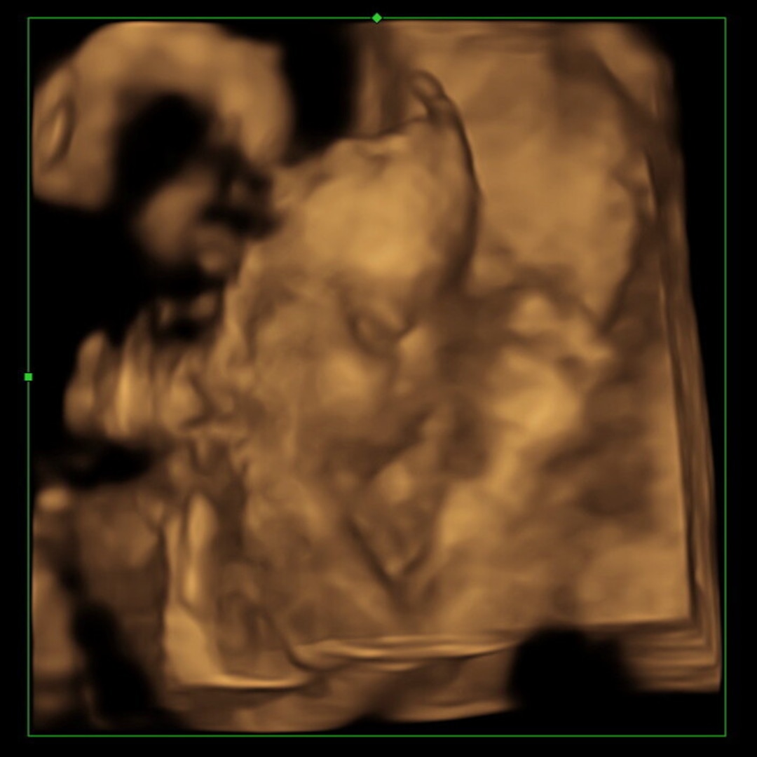 Photo shared by Brianna for their Babylist baby registry.