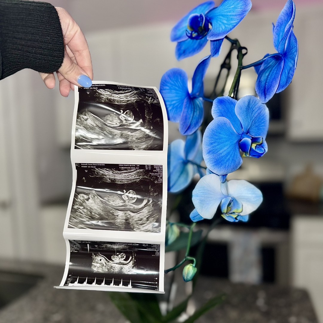Photo shared by Sumer for their Babylist baby registry.