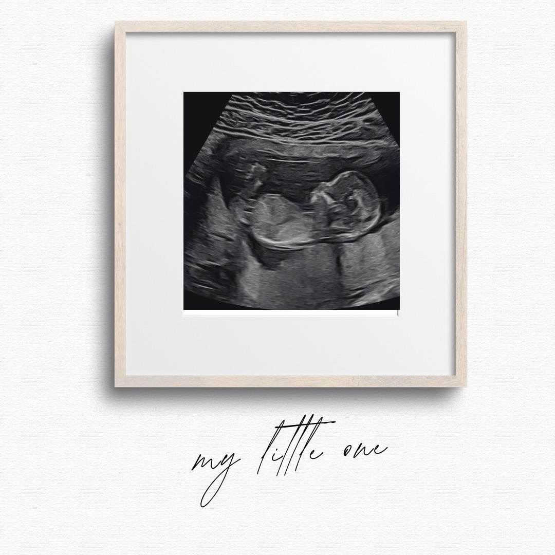 Photo shared by Ona for their Babylist baby registry.