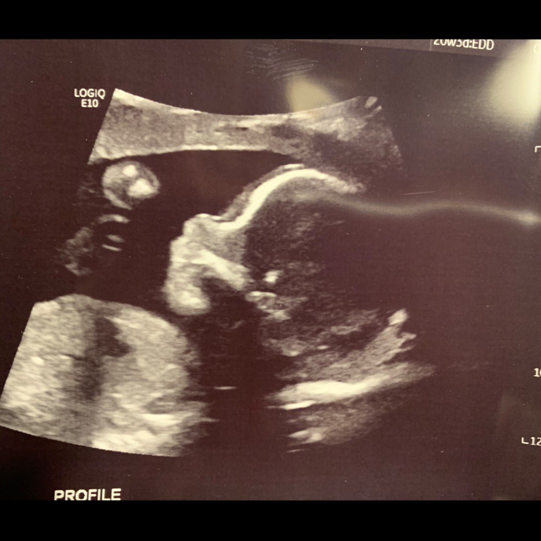 Photo shared by Dale for their Babylist baby registry.