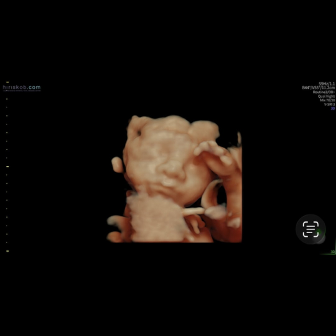 Photo shared by Karinn for their Babylist baby registry.