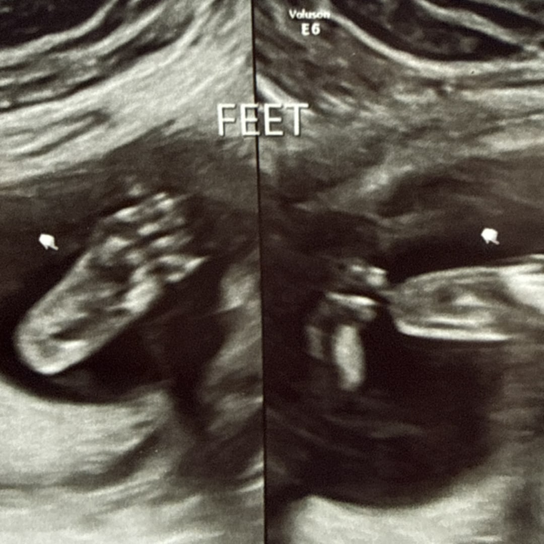 Photo shared by Jessica for their Babylist baby registry.