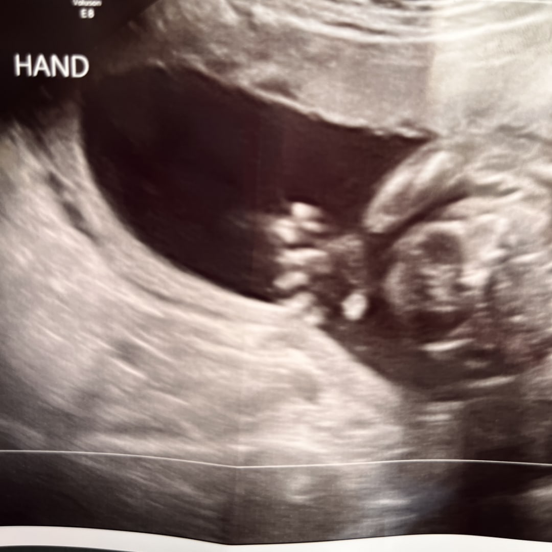 Photo shared by Elaina for their Babylist baby registry.