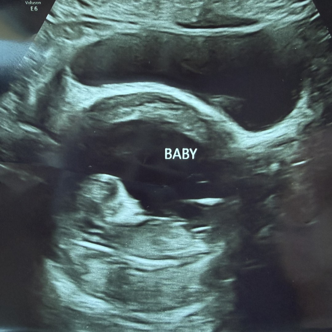 Photo shared by Elizabeth for their Babylist baby registry.