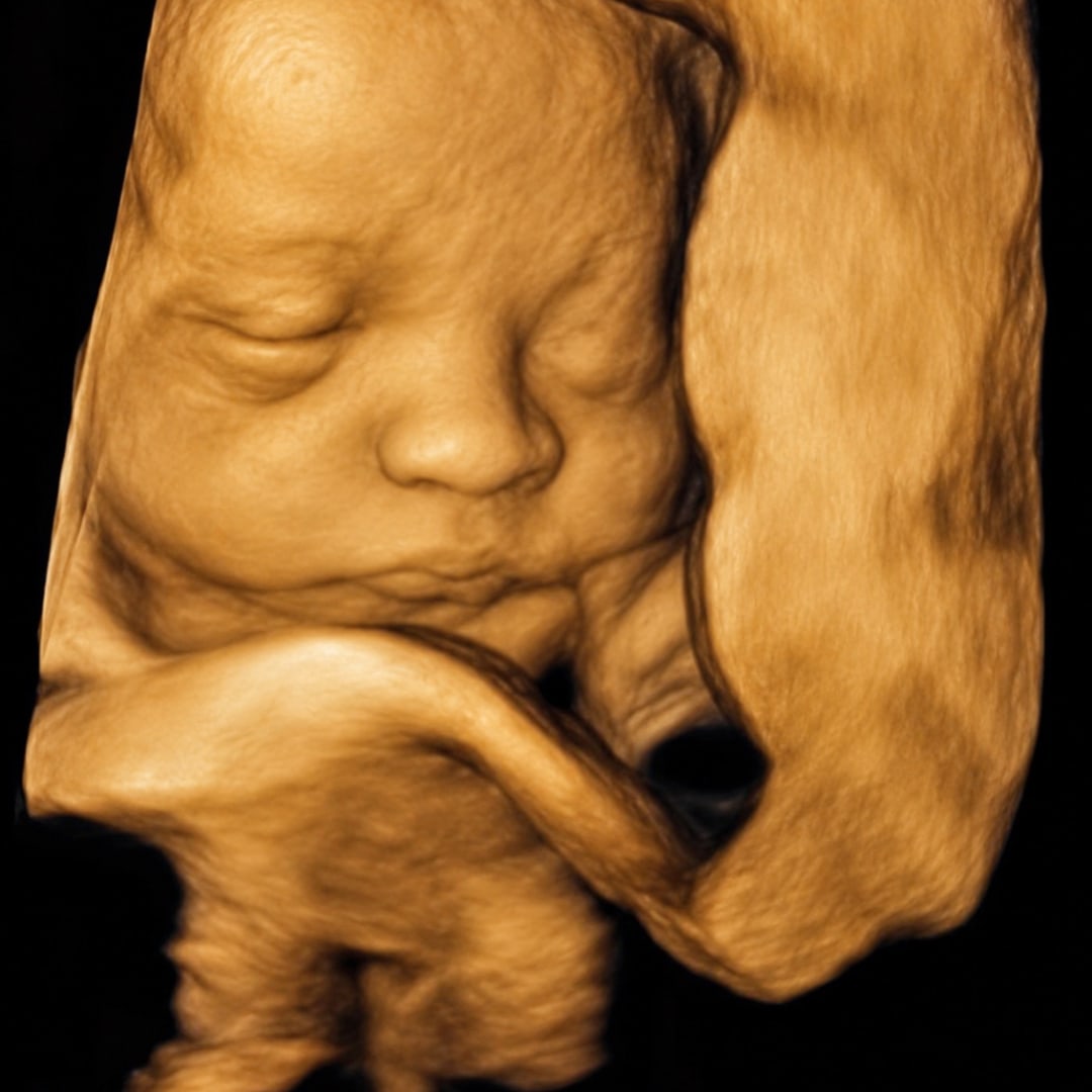 Photo shared by Mia for their Babylist baby registry.