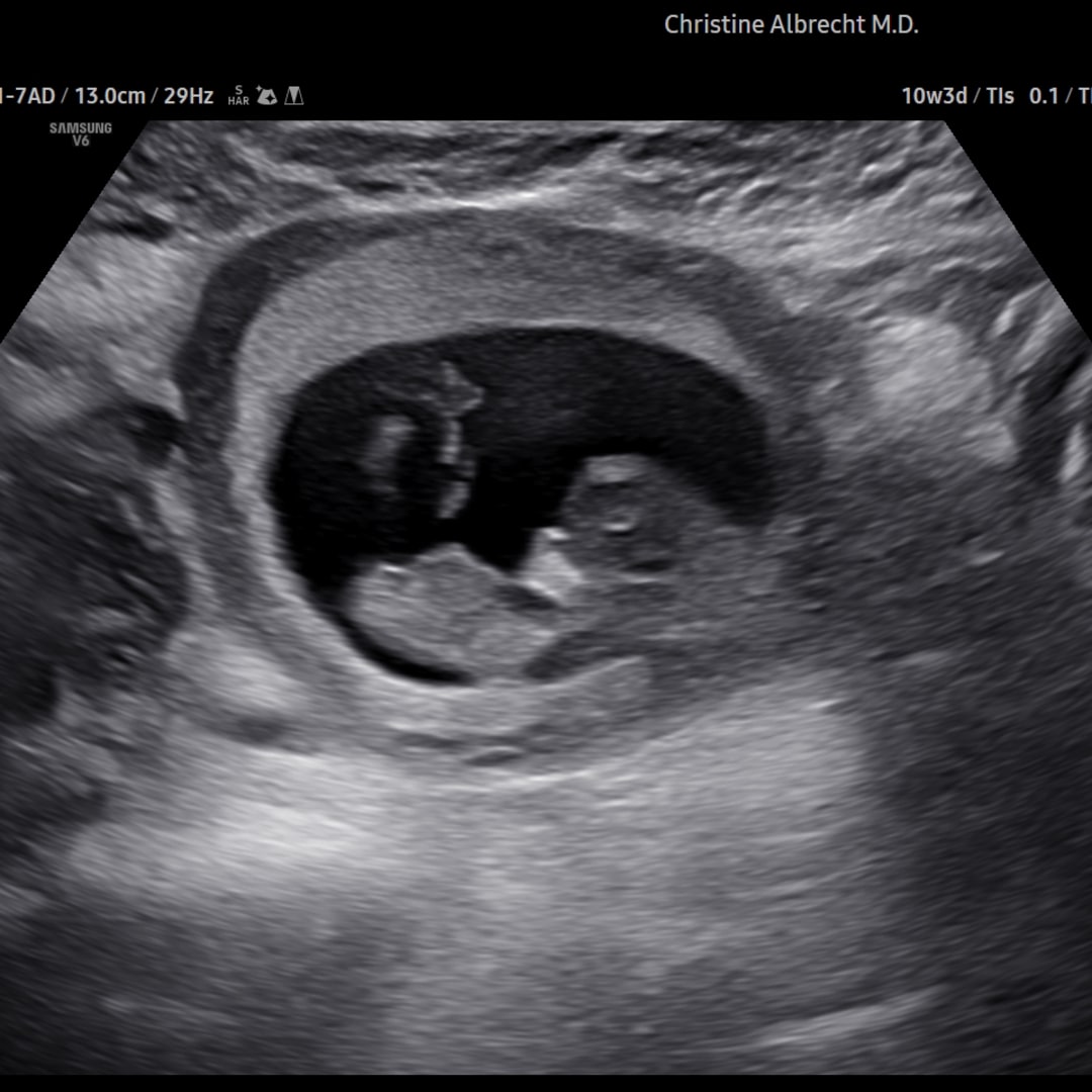 Photo shared by Kamryn for their Babylist baby registry.