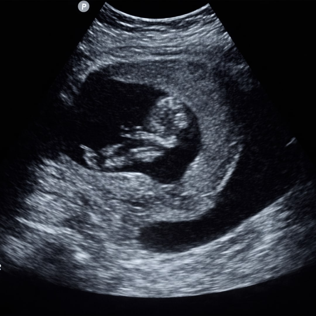 Photo shared by Chasity for their Babylist baby registry.